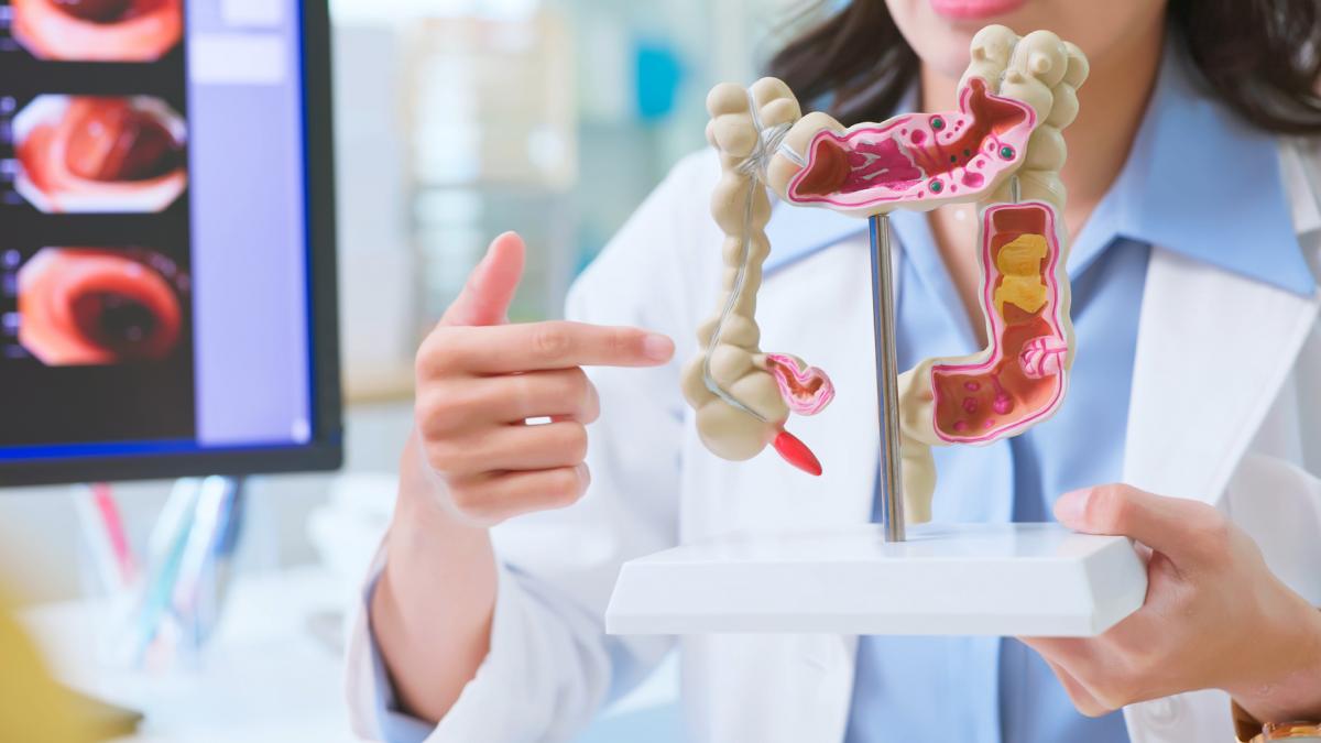 De ce un numar tot mai mare de tineri dezvolta cancer colorectal In unele tari aceasta a devenit principala cauza de deces